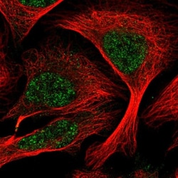 ADCK1 Antibody, Novus Biologicals 25 &mu;L, Unlabeled:Antibodies, Polyclonal